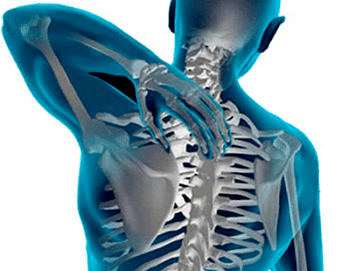 Manifestations of the osteochondrosis of the thoracic spine